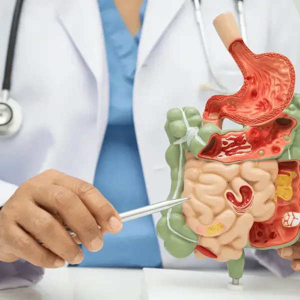 Doctor explaining human digestive system model at Nazarenus Hospital Internal Medicine Department in Bulacan