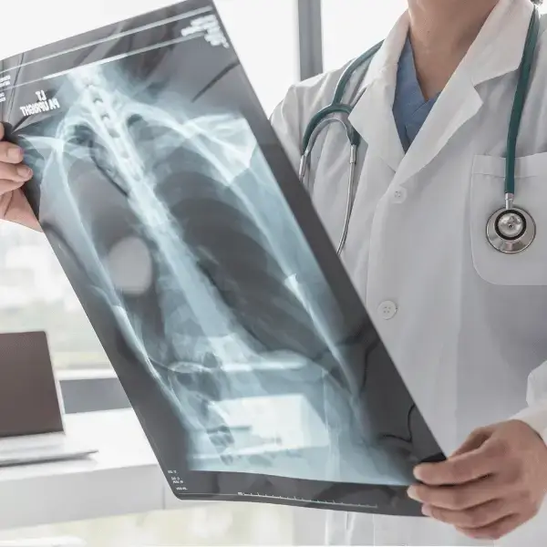 Doctor examining a chest X-ray film at Nazarenus Hospital Radiology Department in Bulacan